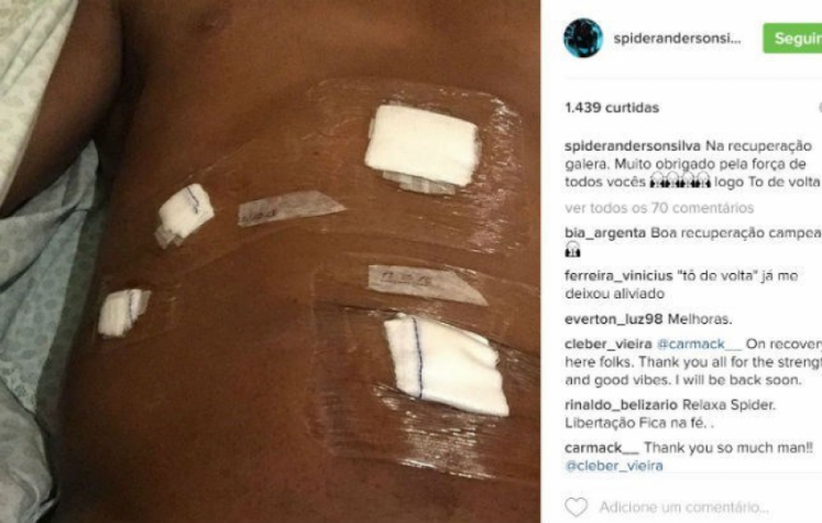 Anderson Silva