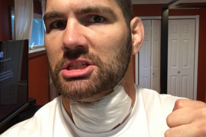 Weidman