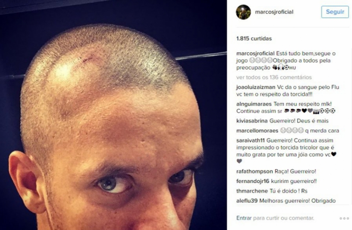 Marcos Junior posta foto do galo em sua cabeça nas redes sociais