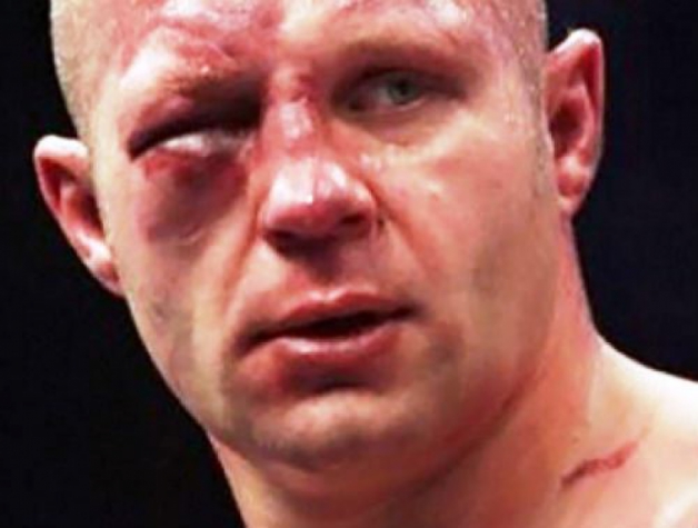 Fedor