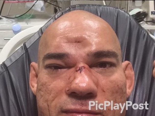 Cyborg