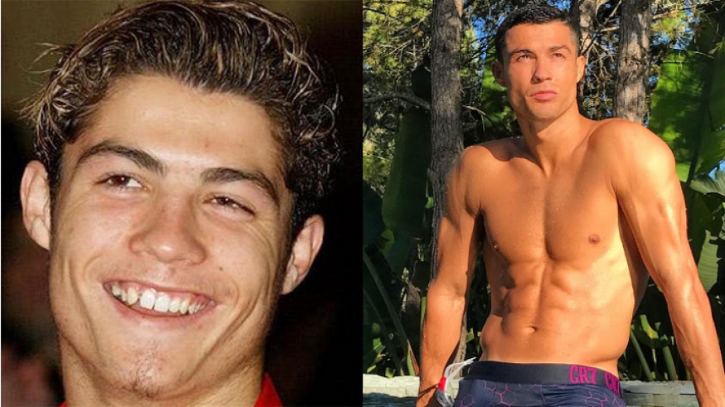 Cristiano Ronaldo - Antes e Depois
