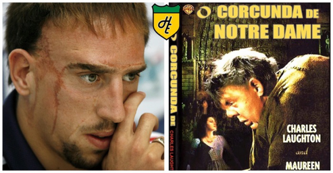 Ribery - O Corcunda de Notre Dame