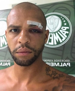 Pressionado, Eduardo Baptista tem de se virar sem três pilares do meio