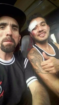 Torcedor agredido no Couto Pereira tem alta e aparece sorrindo em foto