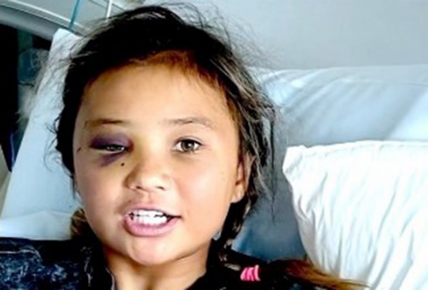 Skatista britânica de 11 anos sofre queda feia em ...
