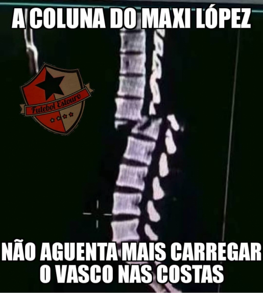 Os melhores memes da vitória do Vasco sobre o Fluminense