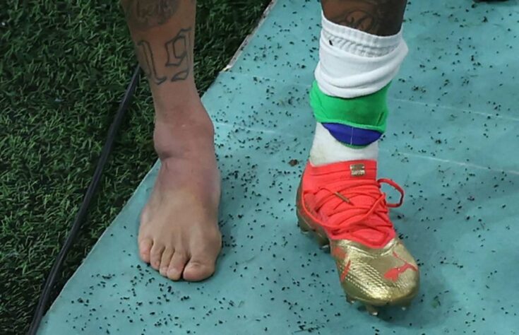 No detalhe o tornozelo inchado de Neymar.