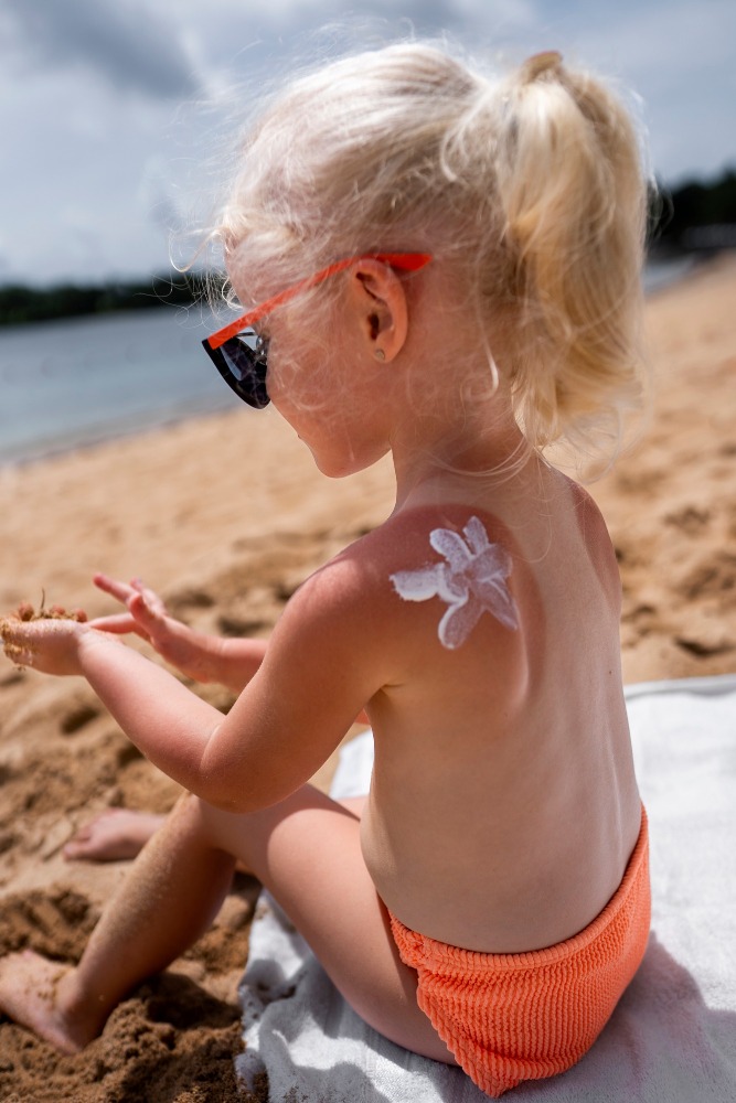 criança com marca de sol nas costas