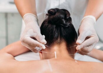 Conheça os benefícios da acupuntura para dores, estresse e saúde geral