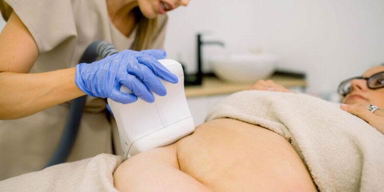 Criolipólise, radiofrequência e ultrassom: tratamentos estéticos para homens
