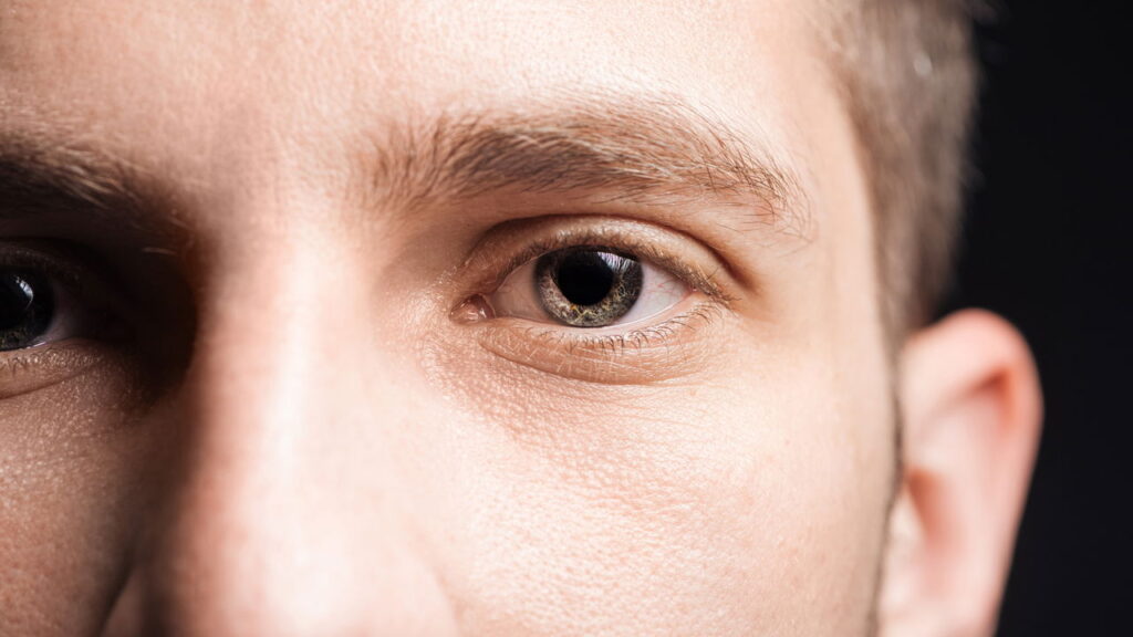 Mais pessoas estão sofrendo com olhos secos e a estação é a culpada