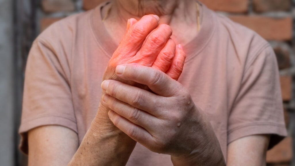 Veja como a má circulação pode afetar seus braços e mãos!