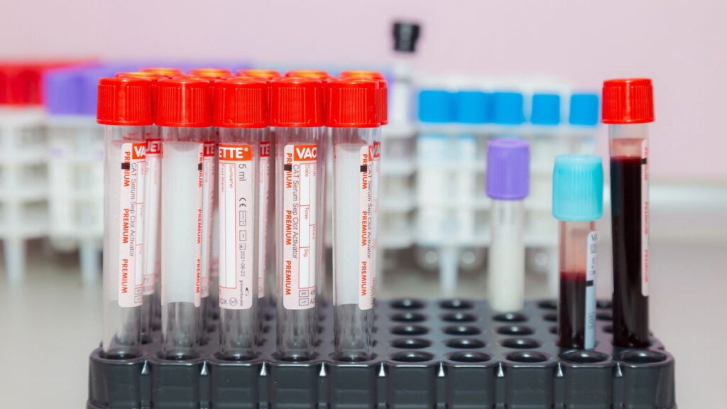 Doping genético, o novo desafio da performance esportiva moderna
