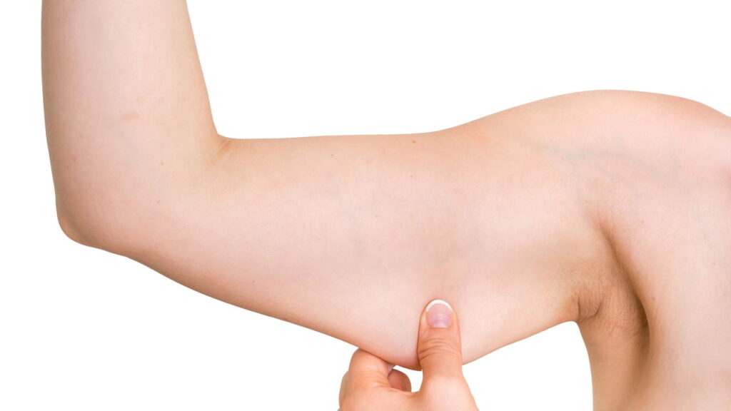 Exercícios eficazes para firmar braços flácidos em casa!