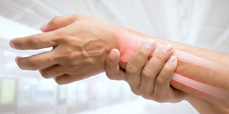 Corrida fortalece ossos e articulações e ajuda a prevenir osteoporose