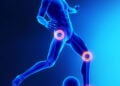 Guia definitivo para prevenir a síndrome do piriforme no futebol
